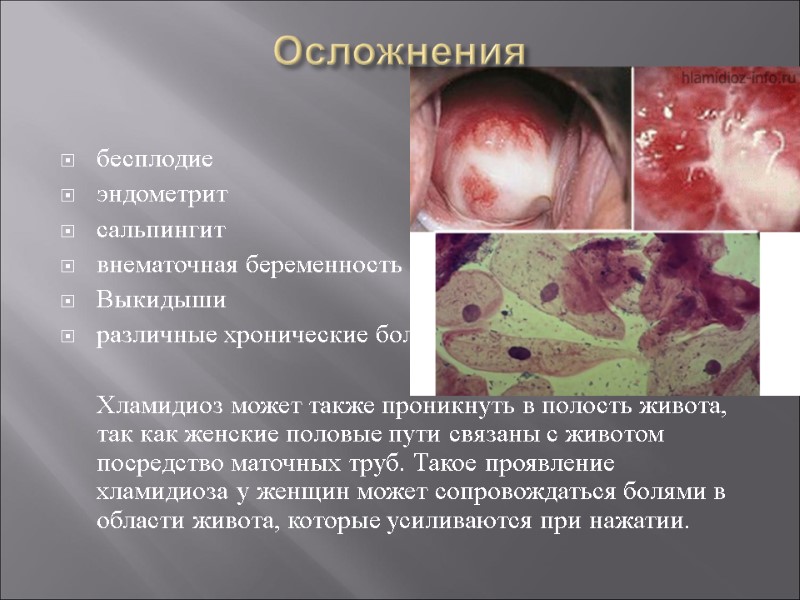 Осложнения  бесплодие эндометрит сальпингит внематочная беременность Выкидыши различные хронические боли   